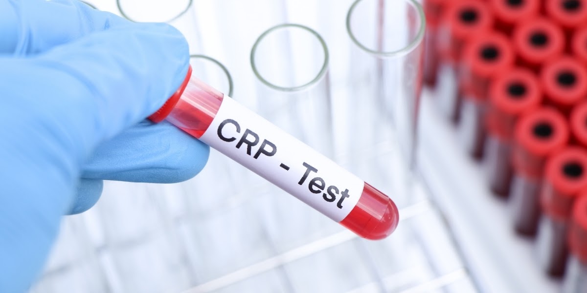 What is C Reactive Protein Blood Test?