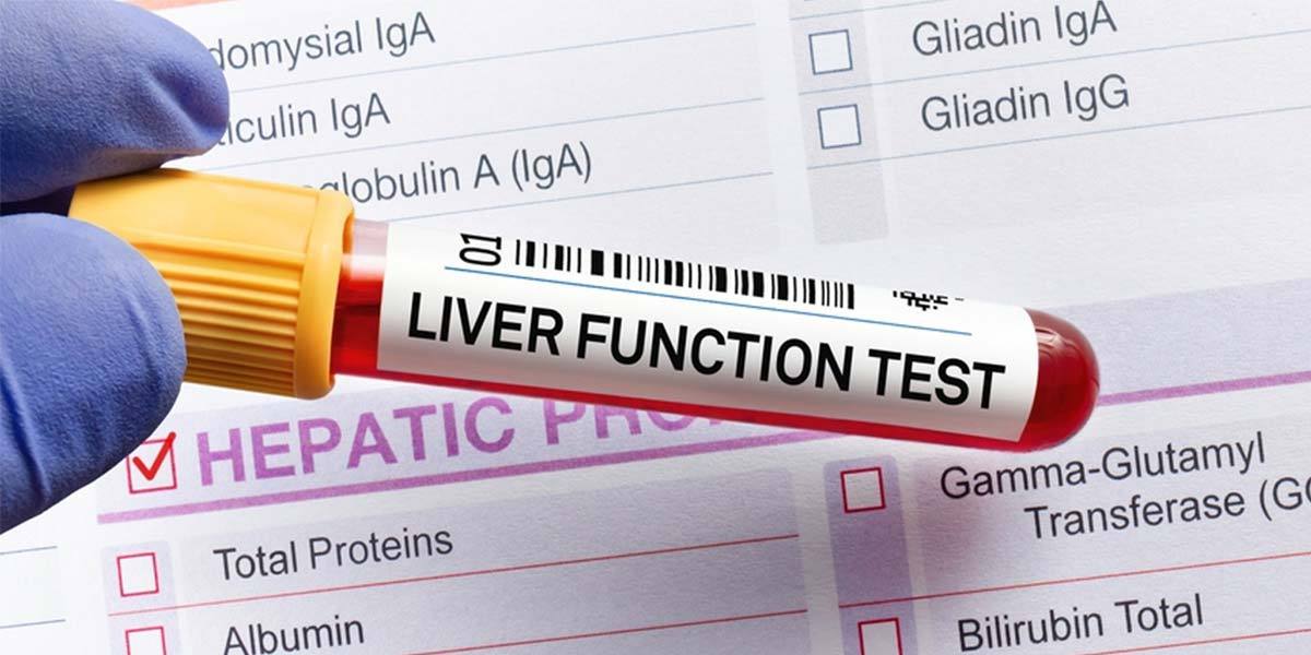 Why Do You Need a Liver Function Test? – @houseofdiagnostics on Tumblr
